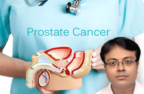भिलाई। बढ़ती उम्र में प्रोस्टेट आकार में बढ़ सकता है। इसके चलते पेशाब में रुकावट और जलन हो सकती है। युरोलॉजिस्ट से अविलंब जांच करवाकर रोग की पहचान की जा सकती है। जल्द पता लगने पर इसका पूर्ण उपचार किया जा सकता है। विलंब होने पर प्रोस्टेट जटिल कैंसर में परिवर्तित हो जाता है जिसका इलाज बेहद कठिन, लम्बा और महंगा हो सकता है। इससे बचाव के लिए पुरुषों को 40 की उम्र के बाद प्रतिवर्ष एक बार पीएसए की जांच करवानी चाहिए।