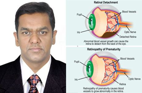 Retina Surgery and RoP can bringdown figures of blindness