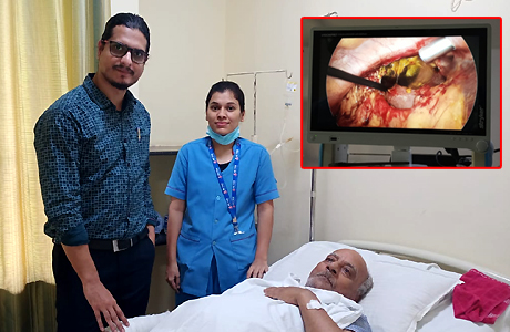 Gall bladder burst case treated at Hitek