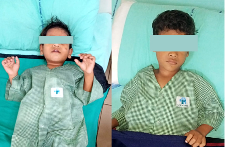 Two patients with Hypospadias treated in Aarogyam