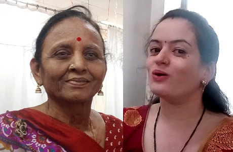 Bell's Palsy patient recovers in 15 days with physiotherapy