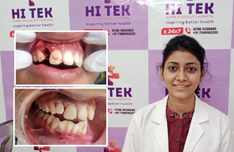 Young women loses tooth in road accident, Hitek docotors fit it back