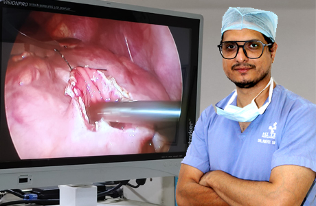 Pseudo Pancreatic Cyst removed by Laparoscopic surgery at Hitek