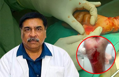 Doctors at Hitek save hand from amputation of a 24 year old youth