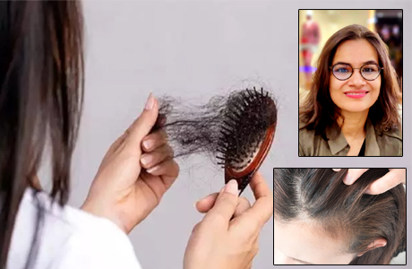 This could be your reason for hair loss