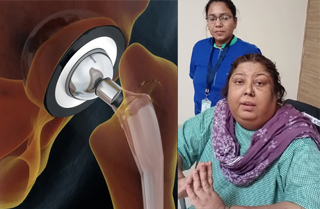 Total hip replacement in overweight elderly woman