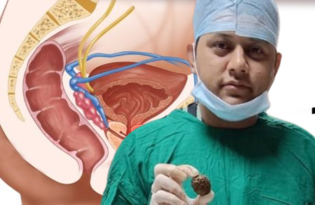Prostate enlargement can have serious implications