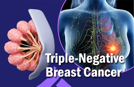 New vaccine promises treatment of Triple Negative Breast Cancer