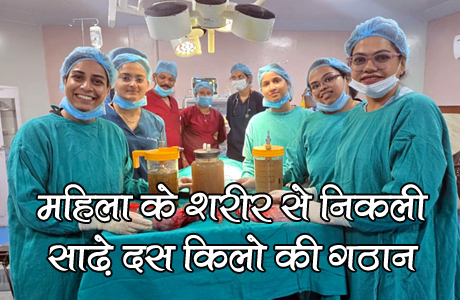 Giant size tumor removed from woman