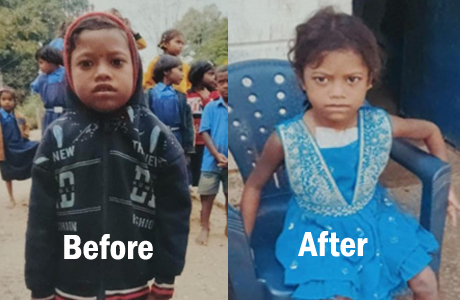 दिव्या के लिए चिरायु योजना बनी वरदान, धड़कनें हुईं सामान्य