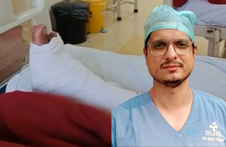 Severe burn case recovers in Hitek Super Speciality Hospital. Limb saved from amputation.