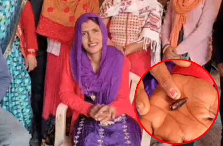 20 साल बाद जांघ से फोड़ा बनकर निकली राइफल से चली गोली