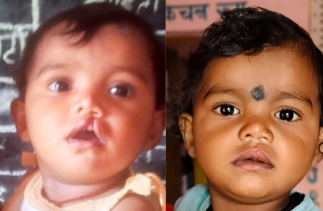 दूर हुई बेटी की चिंता, चिरायु दल ने लौटाई मासूम रंजना की मुस्कान