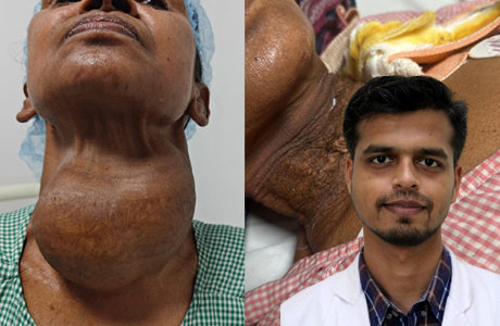 जब सांस लेना भी हुआ मुश्किल तो ओड़ीशा से हाइटेक आ पहुंची मरीज