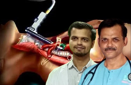 मीडियास्टिनोस्कोप से निकाला महिला के सीने में जमा मवाद