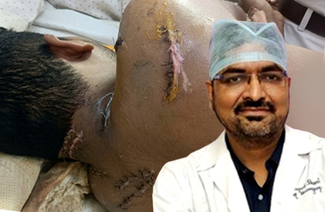 कुल्हाड़ी से दनादन गर्दन पर किए कई वार, हाइटेक में बची जान